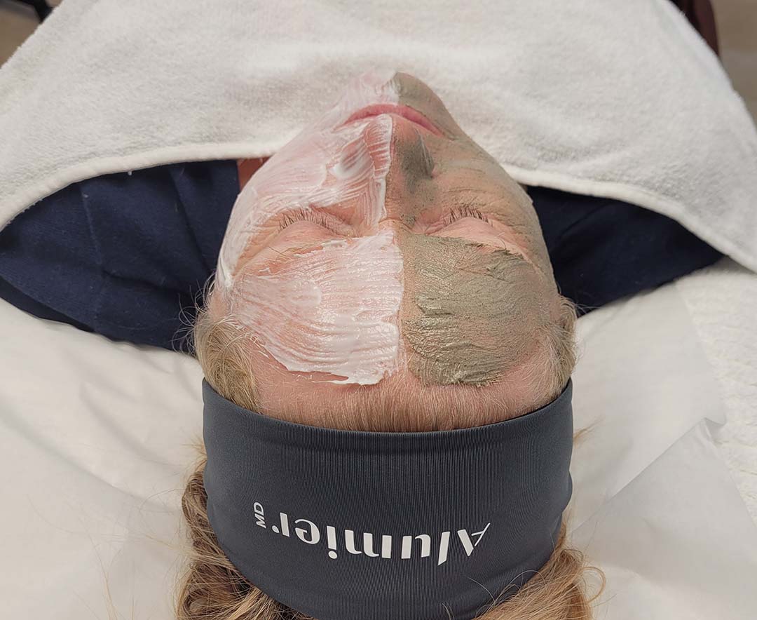 Female patient receiving chemical peel treatment