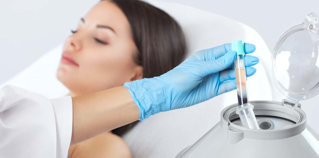 Female patient prp vampire facelift