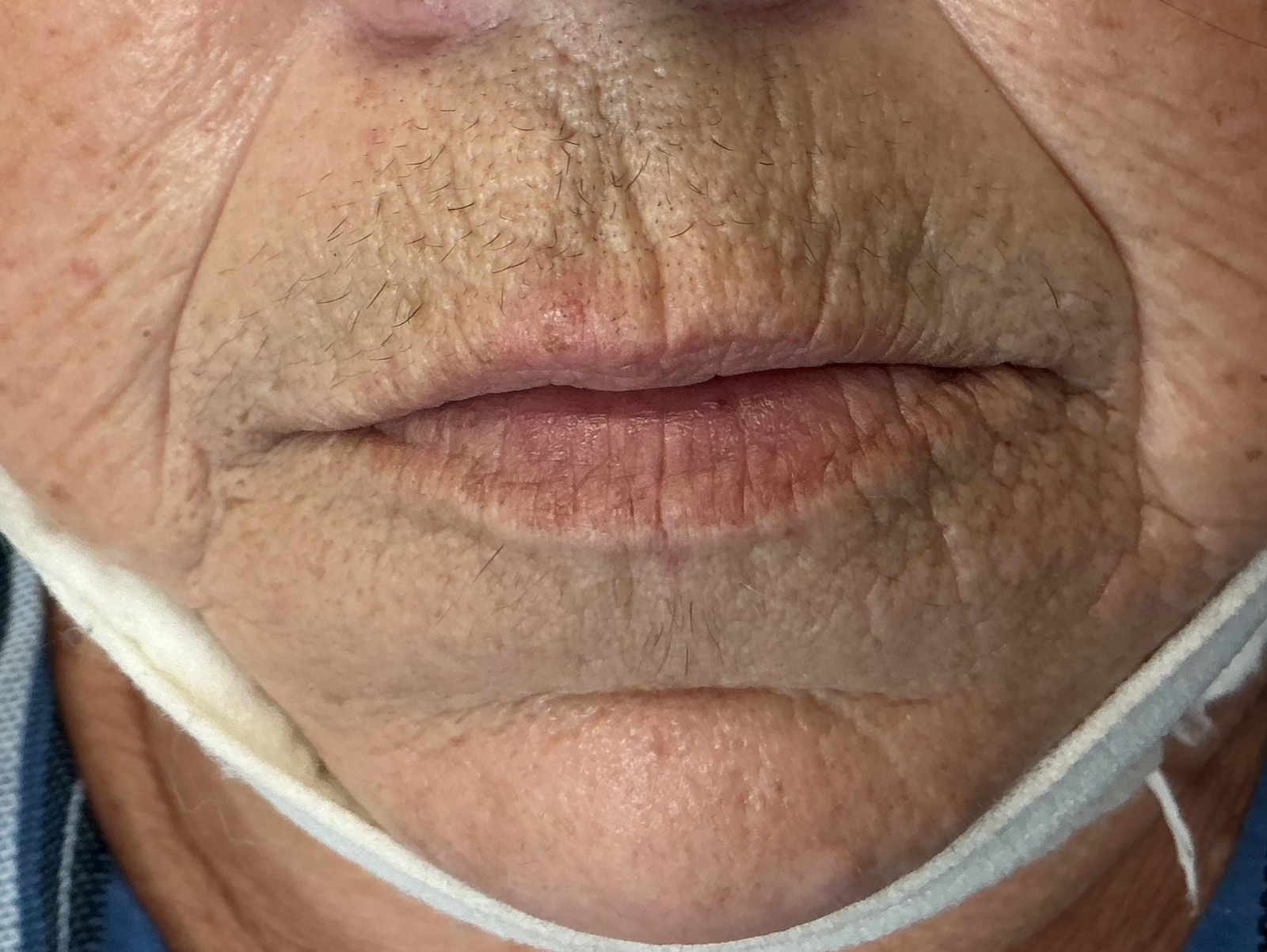 These photos are published for information; only to provide information on the nature of the intervention. It does not constitute a guarantee of results.