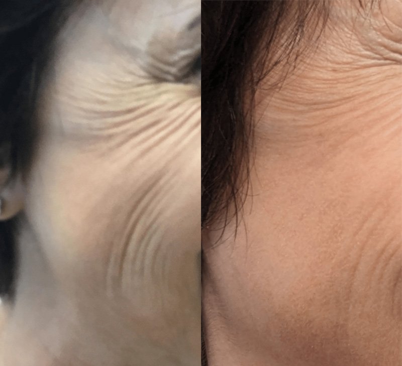 * Ces photos sont publiées à titre indicatif afin de fournir l’information sur la nature de l’intervention. Elles ne constituent aucunement une garantie de résultat.