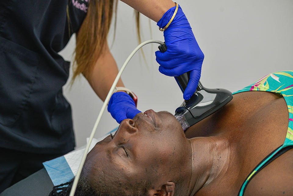 Neck wrinkle treatment with microneedling and radio frequency