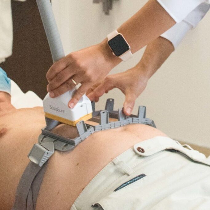 Patient having Sculpsure treatment